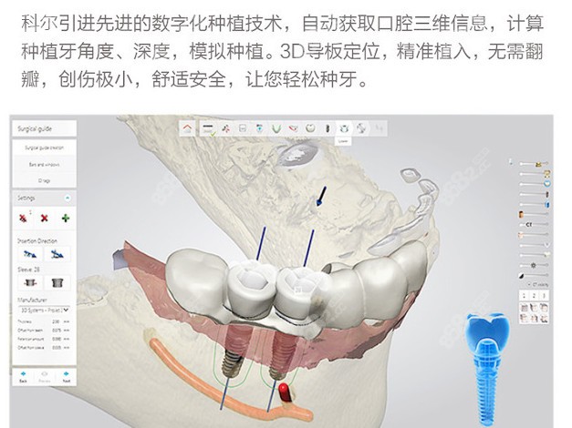 數(shù)字化口腔是什么doc