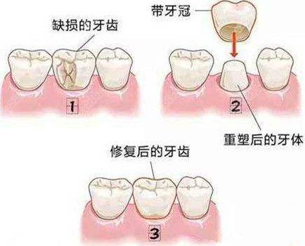 豫健科普成年人如何維護(hù)口腔健康