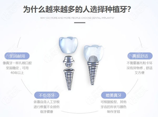 Kaiyun：數(shù)字化是正畸行業(yè)發(fā)展方向專家：數(shù)字化技術協(xié)助診治精準化