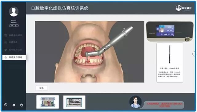 數字化口腔種植關鍵基礎技術研究docx