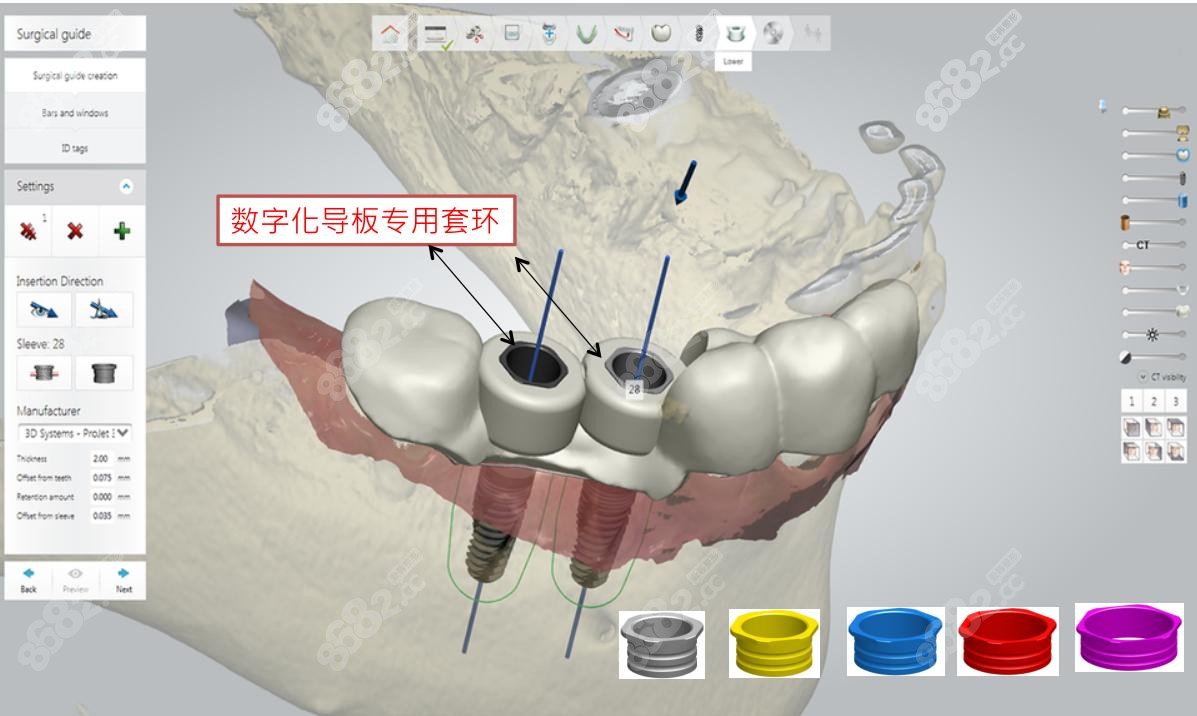數(shù)字化牙科診療技術(shù)
