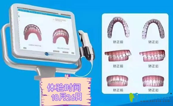 Kaiyun：數(shù)字化口腔治療的前景分析