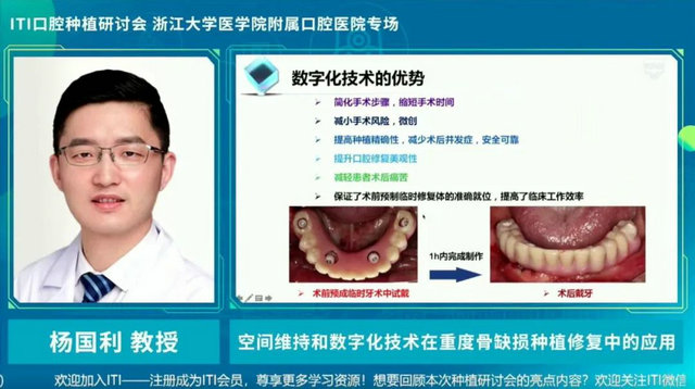 數(shù)字化種植牙與傳統(tǒng)種植牙有啥區(qū)別？