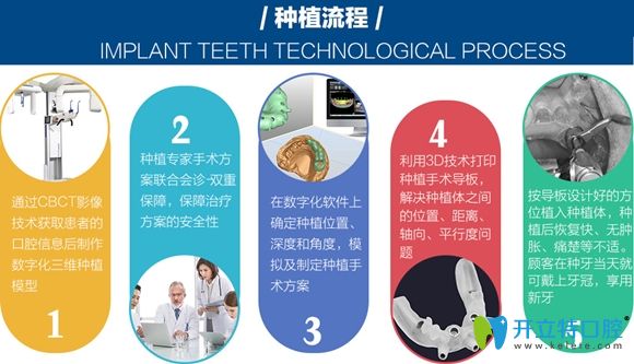 數(shù)字化種植牙是怎么回事