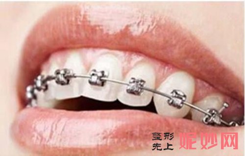 菲森科技閃耀2024湖南口腔展AI科技引領(lǐng)行業(yè)飛躍開(kāi)啟增長(zhǎng)新紀(jì)元